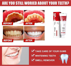 Yayashi SP4 Probiotic Whitening Toothpaste 120g – Removes Coffee, Tea & Smoking Stains