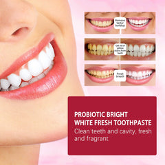 Yayashi SP4 Probiotic Whitening Toothpaste 120g – Removes Coffee, Tea & Smoking Stains