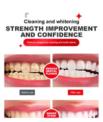 Yayashi SP4 Probiotic Whitening Toothpaste 120g – Removes Coffee, Tea & Smoking Stains