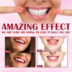 Yayashi SP4 Probiotic Whitening Toothpaste 120g – Removes Coffee, Tea & Smoking Stains